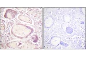 Immunohistochemistry analysis of paraffin-embedded human placenta, using Cyclin B1 (Phospho-Ser147) Antibody. (Cyclin B1 anticorps  (pSer147))