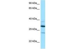 Image no. 1 for anti-Deoxyhypusine Hydroxylase/monooxygenase (DOHH) (AA 63-112) antibody (ABIN6748094) (DOHH anticorps  (AA 63-112))