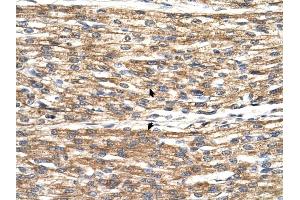 PNPLA3 antibody was used for immunohistochemistry at a concentration of 4-8 ug/ml to stain Myocardial cells (arrows) in Human Heart.