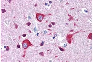 Human Brain, Cortex: Formalin-Fixed, Paraffin-Embedded (FFPE) (ZEB2 anticorps  (C-Term))