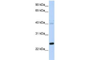 WB Suggested Anti-HSPB8 Antibody Titration: 0. (HSPB8 anticorps  (N-Term))