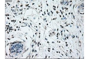 Image no. 2 for anti-Nuclear Receptor Binding Protein 1 (NRBP1) antibody (ABIN1499825)