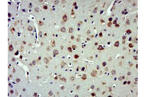 Paraformaldehyde-fixed, paraffin embedded Mouse Brain Antigen retrieval by boiling in sodium citrate buffer (pH6.