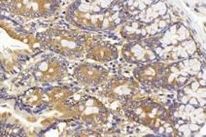 Immunohistochemistry analysis of paraffin-embedded rat colon using CD13(ABIN7072989) at dilution of 1:1000. (CD13 anticorps)