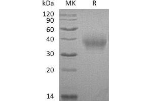 Western Blotting (WB) image for CD80 (CD80) protein (His tag) (ABIN7320994) (CD80 Protein (CD80) (His tag))