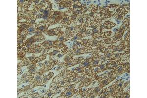 Used in DAB staining on fromalin fixed paraffin- embedded Kidney tissue