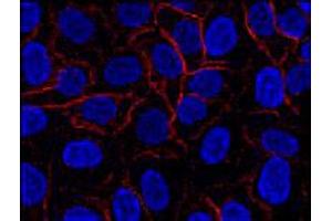 Immunofluorescence staining of AHNAK in HeLa cell line using AHNAK monoclonal antibody, clone EM-09 (Cat # MAB3607 ; red). (AHNAK anticorps  (N-Term))