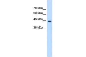 Western Blotting (WB) image for anti-Phosphate Cytidylyltransferase 2, Ethanolamine (PCYT2) antibody (ABIN2462716)