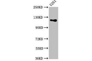Western Blot Positive WB detected in: U251 whole cell lysate All lanes: GUCY2D antibody at 5. (GUCY2D anticorps  (AA 362-462))