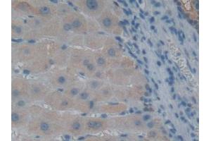 DAB staining on IHC-P; Samples: Human Liver Tissue (GLRX3 anticorps  (AA 144-234))