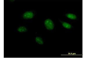 Immunofluorescence of purified MaxPab antibody to ARL3 on HeLa cell.