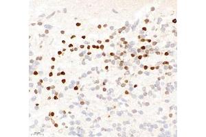 Immunohistochemistry of paraffin embedded rat embryonic rat using OTX2 (ABIN7074952) at dilution of 1:600 (400x lens) (OTX2 anticorps)