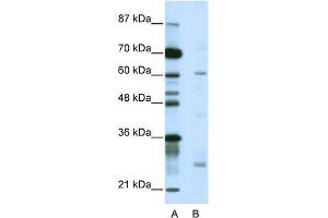 WB Suggested Anti-NR1I2 Antibody Titration:  5. (NR1I2 anticorps  (C-Term))