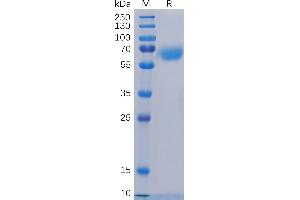 Human CD48 Protein, hFc Tag on SDS-PAGE under reducing condition.