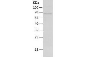 Western Blotting (WB) image for P-Cadherin (CDH3) (AA 108-654) protein (His tag) (ABIN7124291) (P-Cadherin Protein (CDH3) (AA 108-654) (His tag))
