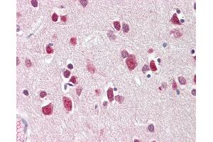 Anti-CITED2 antibody IHC staining of human brain, cortex.