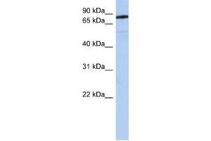 Western Blotting (WB) image for anti-Sema Domain, Immunoglobulin Domain (Ig), Transmembrane Domain (TM) and Short Cytoplasmic Domain, (Semaphorin) 4B (SEMA4B) antibody (ABIN2459293) (SEMA4B anticorps)