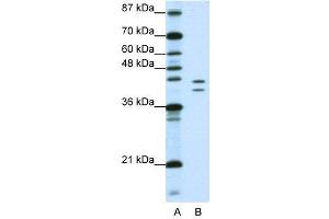 WB Suggested Anti-HNRPD  Antibody Titration: 1. (HNRNPD/AUF1 anticorps  (N-Term))
