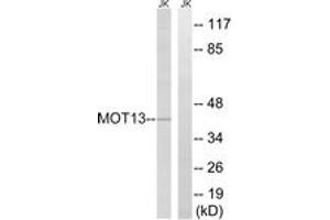 Western blot analysis of extracts from Jurkat cells, using MOT13 Antibody. (SLC16A13 anticorps  (AA 377-426))