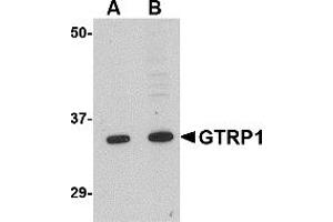 Western Blotting (WB) image for anti-Growth Hormone Regulated TBC Protein 1 (GRTP1) (N-Term) antibody (ABIN1031398) (GRTP1 anticorps  (N-Term))