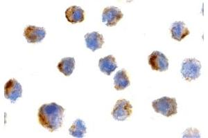 Immunohistochemistry (IHC) image for anti-Peptidyl-tRNA Hydrolase 2 (PTRH2) (N-Term) antibody (ABIN1031275) (PTRH2 anticorps  (N-Term))