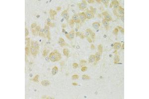 Immunohistochemistry of paraffin-embedded rat brain using SLC37A4 antibody (ABIN6292412) at dilution of 1:100 (40x lens). (SLC37A4 anticorps)