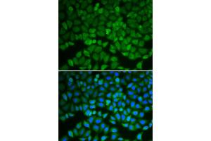 Immunofluorescence analysis of A549 cells using GSS antibody (ABIN6290429).
