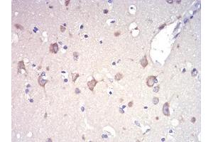 Immunohistochemical analysis of paraffin-embedded brain tissues using RAD21 mouse mAb with DAB staining. (RAD21 anticorps  (AA 287-403))