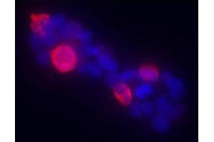 Anti-Gli-1 Antibody - Immunofluorescence.