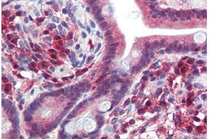 Human Small Intestine (formalin-fixed, paraffin-embedded) stained with TRIM35 antibody ABIN462195 followed by biotinylated goat anti-rabbit IgG secondary antibody ABIN481713, alkaline phosphatase-streptavidin and chromogen.