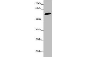 Western blot All lanes: SLC6A12 antibody at 4. (SLC6A12 anticorps  (AA 515-614))