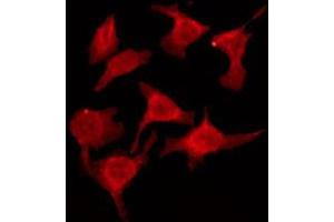 ABIN6274572 staining HeLa by IF/ICC. (Serotonin Receptor 2B anticorps  (Internal Region))