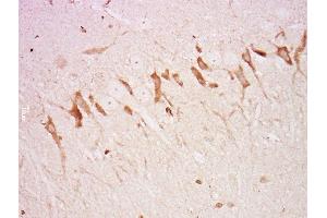 Paraformaldehyde-fixed, paraffin embedded rat brain, Antigen retrieval by boiling in sodium citrate buffer (pH6) for 15min, Block endogenous peroxidase by 3% hydrogen peroxide for 30 minutes, Blocking buffer (normal goat serum) at 37°C for 20min, Antibody incubation with Rabbit Anti-Neurofascin Polyclonal Antibody, Unconjugated  at 1:500 overnight at 4°C, followed by a conjugated secondary and DAB staining.