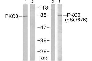 Western blot analysis of extracts from Jurkat cells untreated or treated with PMA (1ng/ml, 5min), using PKCθ (Ab-676) antibody (E021289, Line 1 and 2) and PKCθ (phospho-Ser676) antibody (E011297, Line 3 and 4). (PKC theta anticorps)