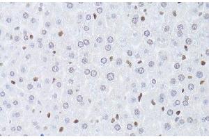 Immunohistochemistry of paraffin-embedded Mouse liver using LMNB2 Polyclonal Antibody at dilution of 1:100 (40x lens).