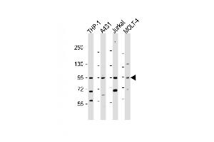 All lanes : Anti-IL12RB2 Antibody (C-term) at 1:2000 dilution Lane 1: THP-1 whole cell lysate Lane 2: A431 whole cell lysate Lane 3: Jurkat whole cell lysate Lane 4: MOLT-4 whole cell lysate Lysates/proteins at 20 μg per lane.