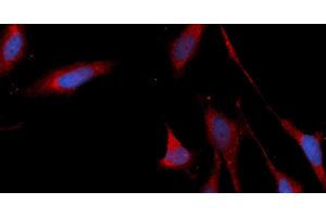 Immunofluorescence (IF) image for anti-Connective Tissue Growth Factor (CTGF) (AA 27-349) antibody (APC) (ABIN5565322)