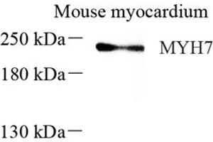 Western blot analysis of MYH7 (ABIN7075623),at dilution of 1: 600 (Slow Skeletal Myosin Heavy Chain anticorps)