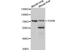 Western Blotting (WB) image for anti-Transforming Growth Factor, beta-Induced, 68kDa (TGFBI) antibody (ABIN1875076) (TGFBI anticorps)