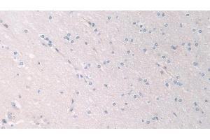 Detection of PANK4 in Human Cerebrum Tissue using Polyclonal Antibody to Pantothenate Kinase 4 (PANK4)