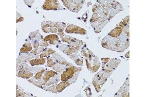 Immunohistochemistry of paraffin-embedded Mouse heart using MRPS6 Polyclonal Antibody at dilution of 1:100 (40x lens). (MRPS6 anticorps)