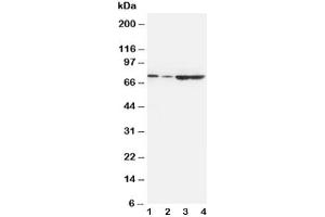 Western blot testing of PCSK9 antibody and Lane 1:  A549