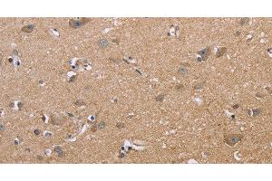 Immunohistochemistry of paraffin-embedded Human brain using MAPRE3 Polyclonal Antibody at dilution of 1:50 (MAPRE3 anticorps)