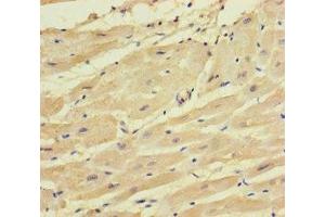 Immunohistochemistry of paraffin-embedded human heart tissue using ABIN7171175 at dilution of 1:100
