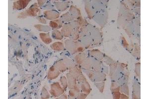 Detection of Flt3 in Mouse Skeletal muscle Tissue using Polyclonal Antibody to FMS Like Tyrosine Kinase 3 (Flt3)