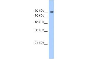 WB Suggested Anti-LAS1L Antibody   Titration: 1. (LAS1L anticorps  (C-Term))