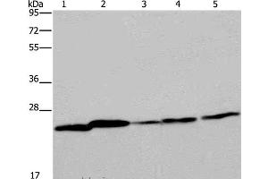 Western Blot analysis of Mouse spleen tissue, A375, A549, HT-29 and Hela cell using ARHGDIA Polyclonal Antibody at dilution of 1:350 (ARHGDIA anticorps)