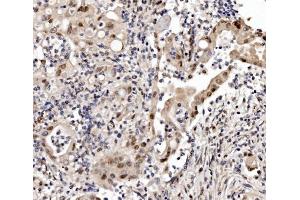 IHC analysis of Cbx8 using anti-Cbx8 antibody (ABIN7599341).