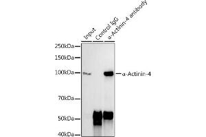 Immunoprecipitation analysis of 300 μg extracts of 293T cells using 3 μg α-Actinin-4 antibody (ABIN7265399). (alpha Actinin 4 anticorps)