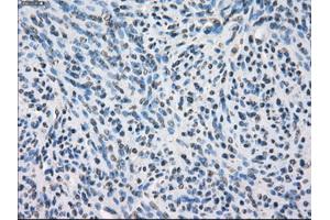 Immunohistochemical staining of paraffin-embedded colon tissue using anti-SLC2A6mouse monoclonal antibody. (SLC2A6 anticorps)